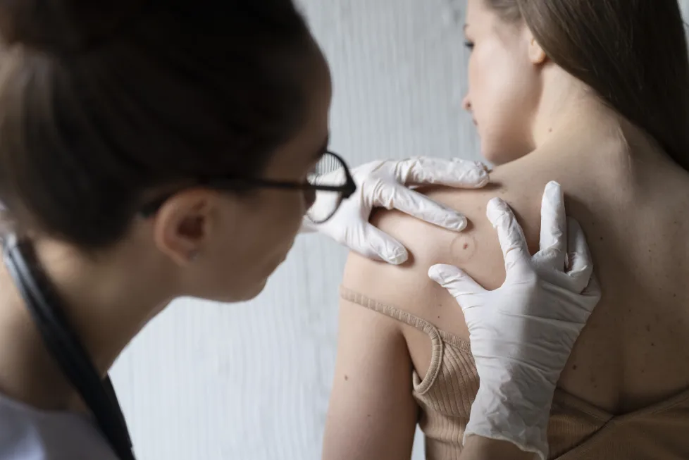 doctora-diagnosticando-un-melanoma-en-el-cuerpo-de-una-paciente